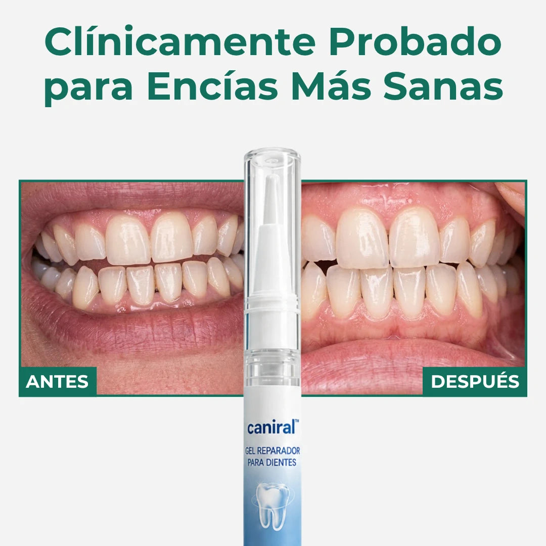 Gel Reparador de Encías