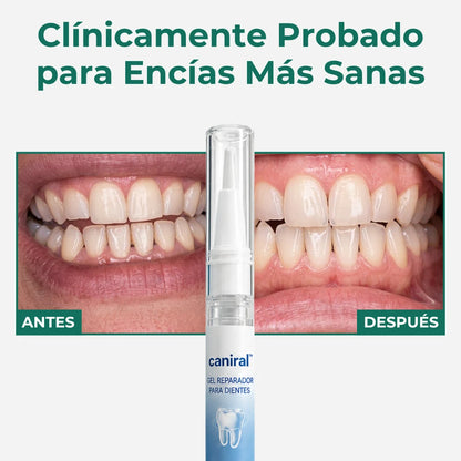 Gel Reparador de Encías