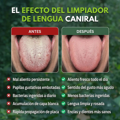 Limpiador de Lengua