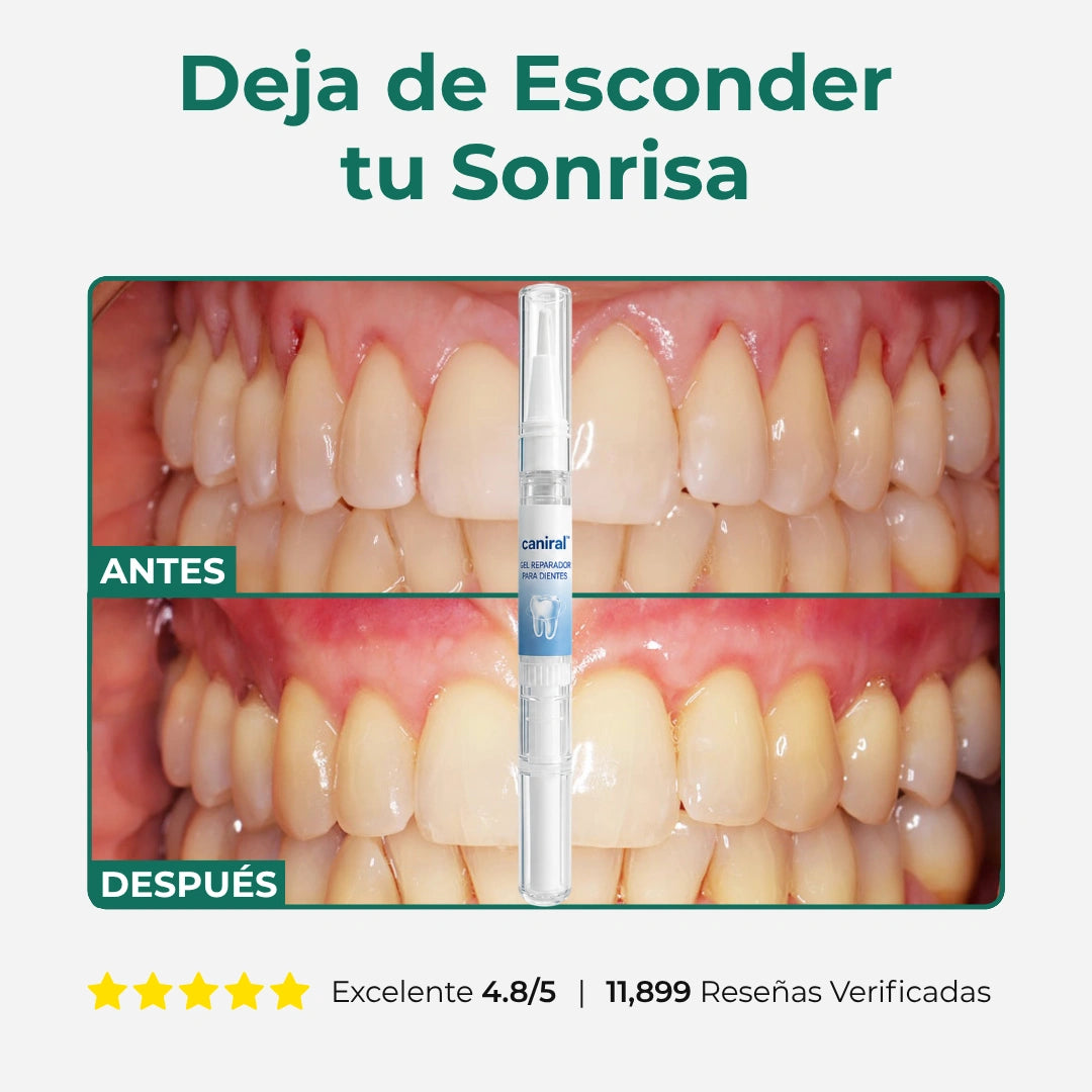 Gel Reparador de Encías