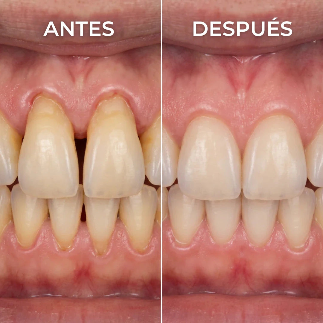 Gel Reparador de Encías