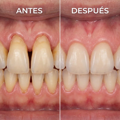Gel Reparador de Encías